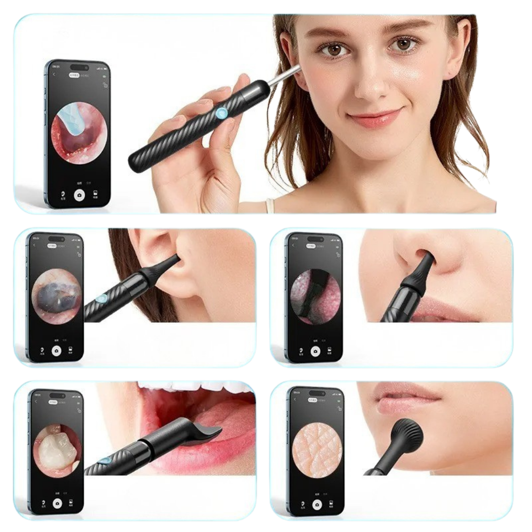 CLEARVISION – Kabellose Ohrkamera Reiniger