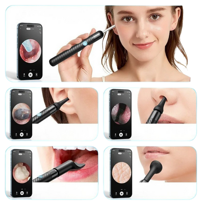 CLEARVISION – Kabellose Ohrkamera Reiniger